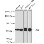 Western Blot - Anti-TAB1 Antibody [ARC1943] (A309138) - Antibodies.com