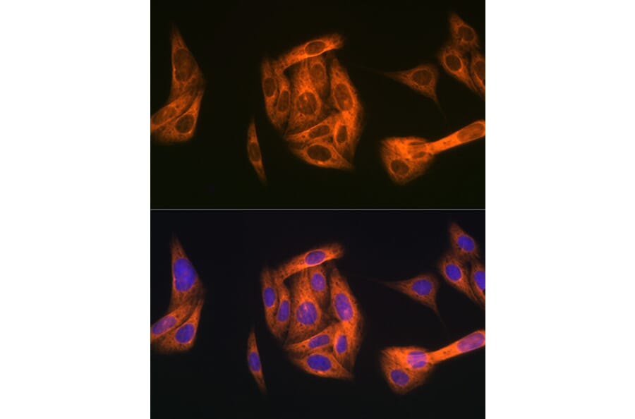 Immunofluorescence - Anti-TAB1 Antibody [ARC1943] (A309138) - Antibodies.com