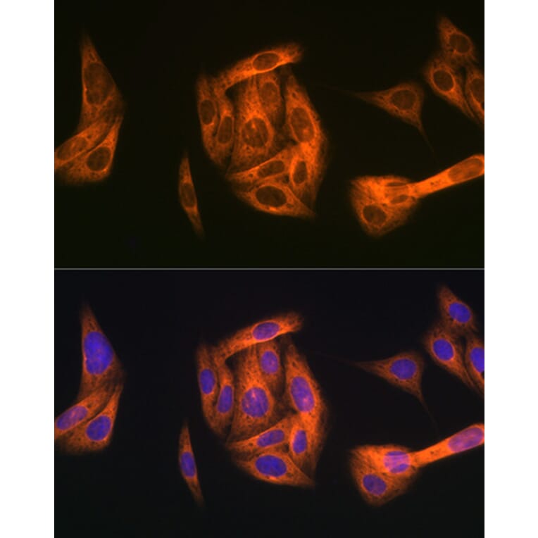 Immunofluorescence - Anti-TAB1 Antibody [ARC1943] (A309138) - Antibodies.com