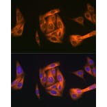 Immunofluorescence - Anti-TAB1 Antibody [ARC1943] (A309138) - Antibodies.com