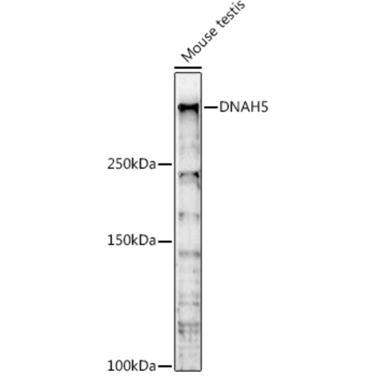 Western Blot - Anti-DNAH5 Antibody (A309139) - Antibodies.com