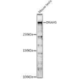 Western Blot - Anti-DNAH5 Antibody (A309139) - Antibodies.com