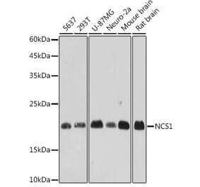 Western Blot - Anti-NCS1 Antibody [ARC2523] (A309140) - Antibodies.com