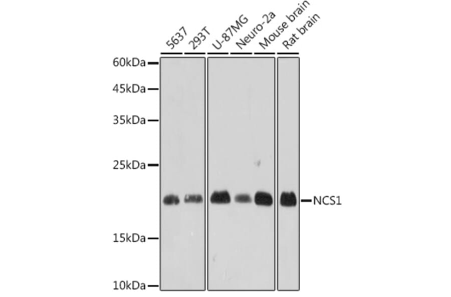Western Blot - Anti-NCS1 Antibody [ARC2523] (A309140) - Antibodies.com