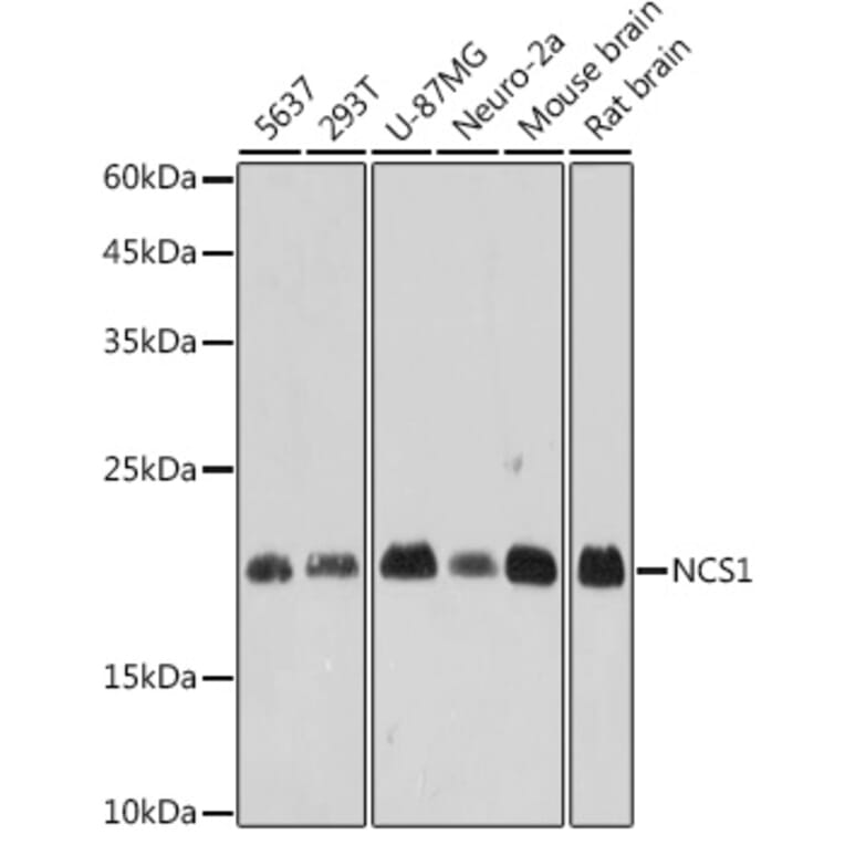 Western Blot - Anti-NCS1 Antibody [ARC2523] (A309140) - Antibodies.com