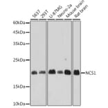 Western Blot - Anti-NCS1 Antibody [ARC2523] (A309140) - Antibodies.com