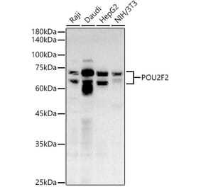 Western Blot - Anti-OCT2 Antibody (A309141) - Antibodies.com