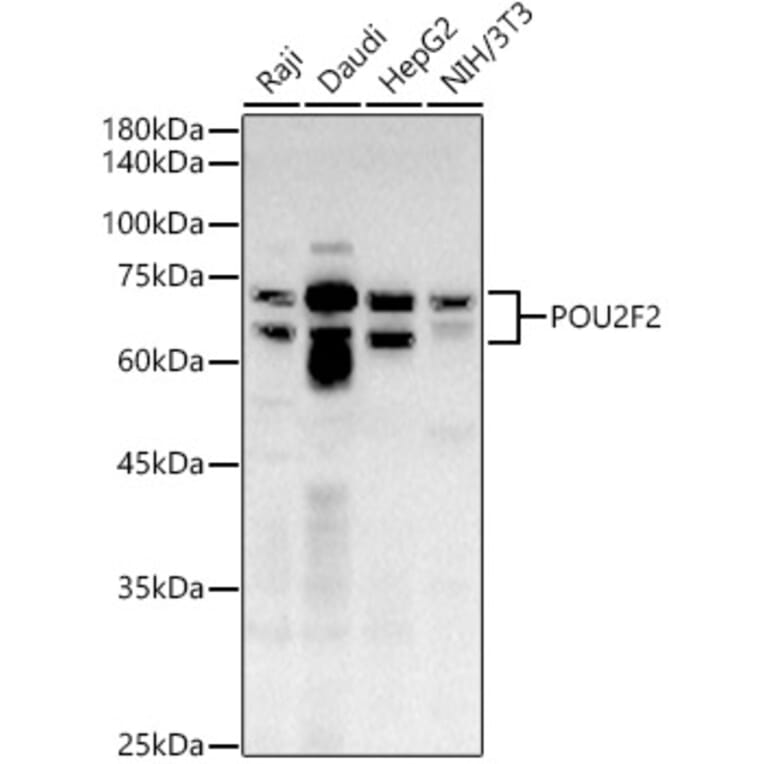 Western Blot - Anti-OCT2 Antibody (A309141) - Antibodies.com