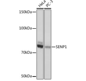 Western Blot - Anti-SENP1 Antibody [ARC1016] (A309142) - Antibodies.com
