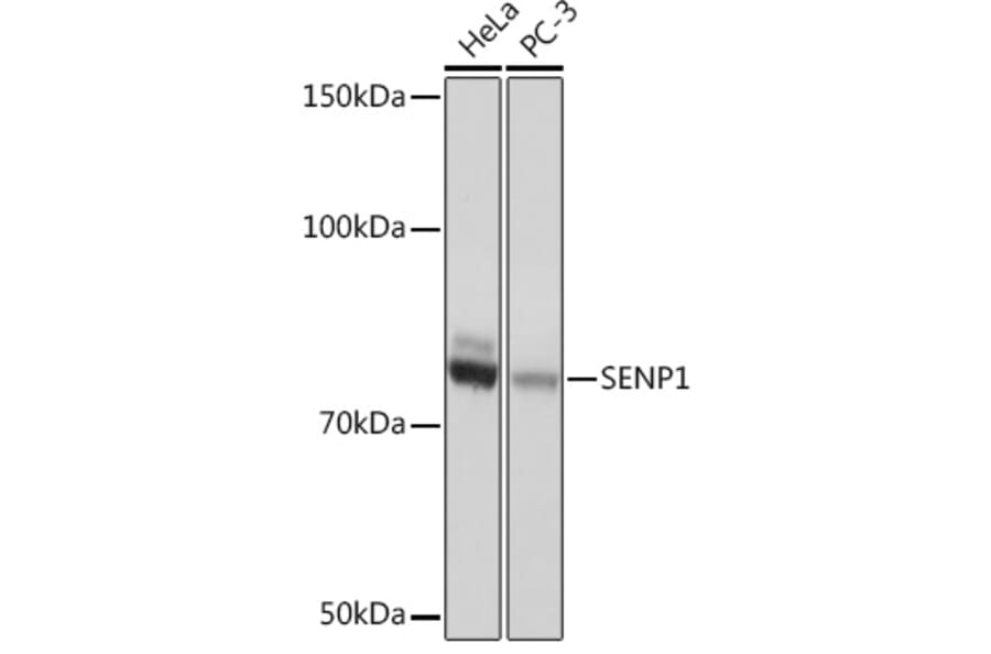 Western Blot - Anti-SENP1 Antibody [ARC1016] (A309142) - Antibodies.com