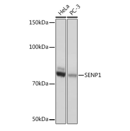 Western Blot - Anti-SENP1 Antibody [ARC1016] (A309142) - Antibodies.com