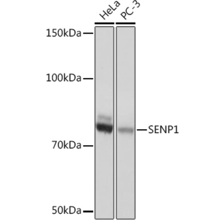Western Blot - Anti-SENP1 Antibody [ARC1016] (A309142) - Antibodies.com