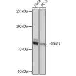 Western Blot - Anti-SENP1 Antibody [ARC1016] (A309142) - Antibodies.com