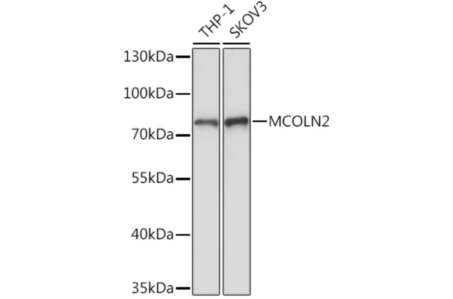 Western Blot - Anti-MCOLN2 Antibody (A309143) - Antibodies.com