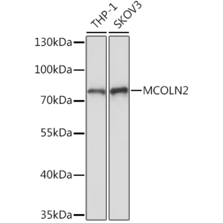 Western Blot - Anti-MCOLN2 Antibody (A309143) - Antibodies.com