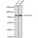 Western Blot - Anti-MCOLN2 Antibody (A309143) - Antibodies.com