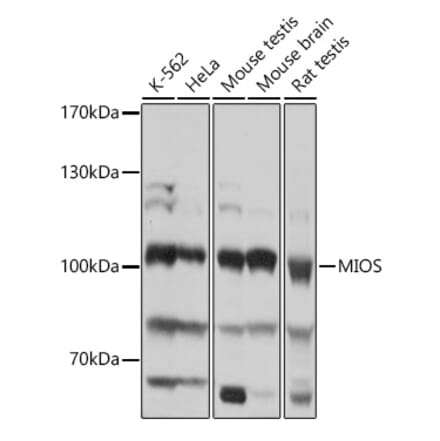 Western Blot - Anti-MIOS Antibody (A309144) - Antibodies.com