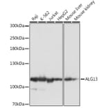 Western Blot - Anti-ALG13 Antibody (A309145) - Antibodies.com