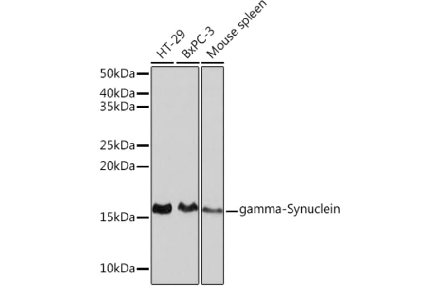 Western Blot - Anti-gamma Synuclein/SNCG Antibody [ARC0762] (A309146) - Antibodies.com