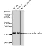 Western Blot - Anti-gamma Synuclein/SNCG Antibody [ARC0762] (A309146) - Antibodies.com