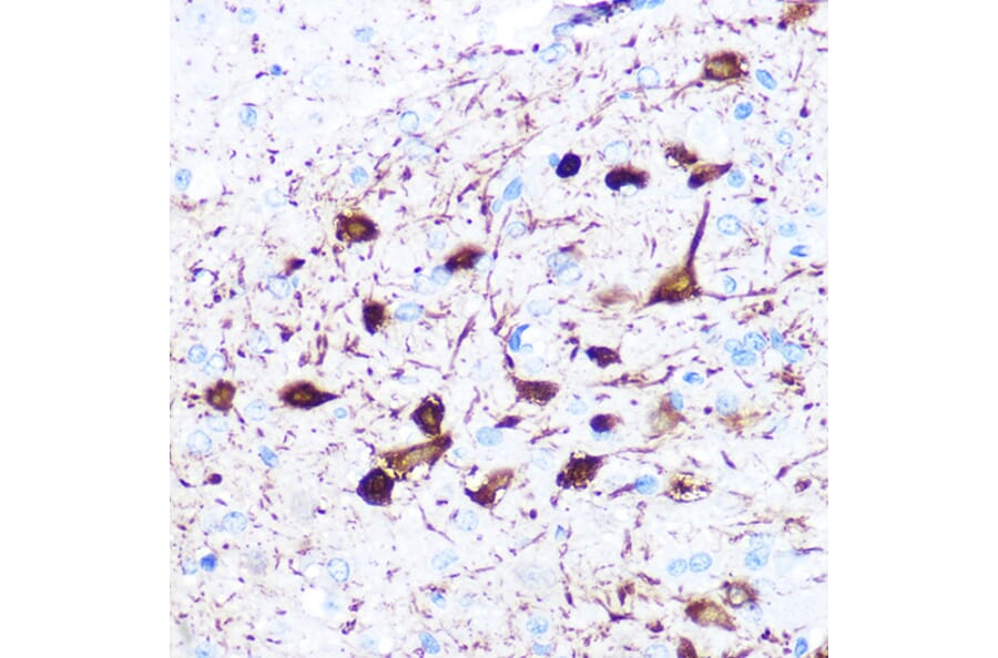 Immunohistochemistry - Anti-gamma Synuclein/SNCG Antibody [ARC0762] (A309146) - Antibodies.com