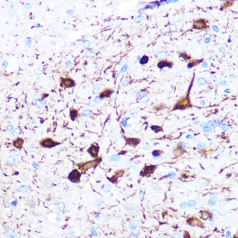 Immunohistochemistry - Anti-gamma Synuclein/SNCG Antibody [ARC0762] (A309146) - Antibodies.com