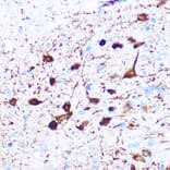 Immunohistochemistry - Anti-gamma Synuclein/SNCG Antibody [ARC0762] (A309146) - Antibodies.com