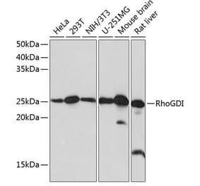 Western Blot - Anti-RhoGDI Antibody [ARC0629] (A309147) - Antibodies.com