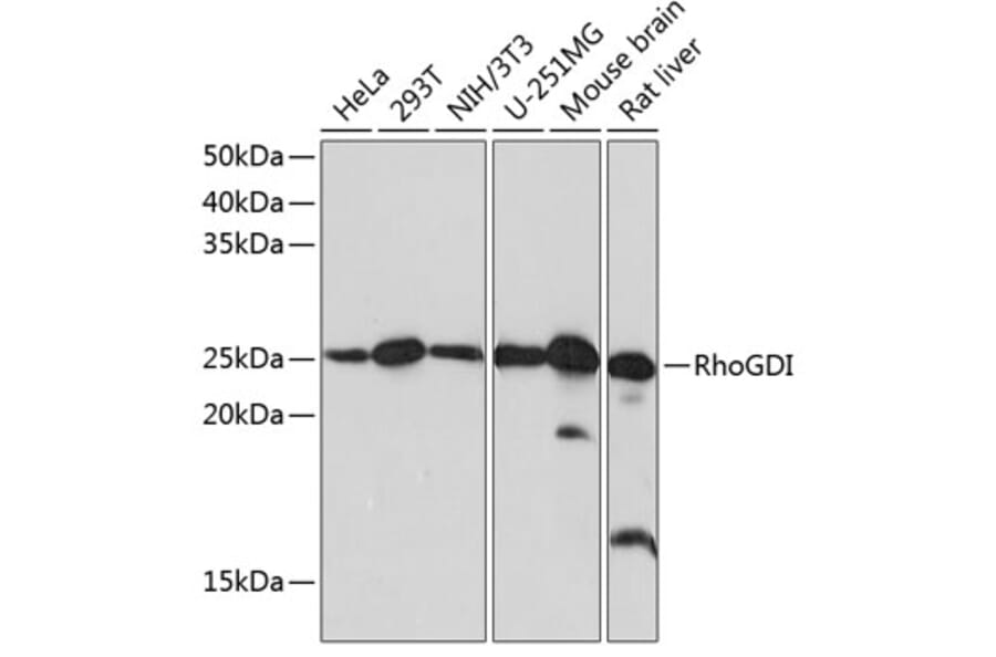 Western Blot - Anti-RhoGDI Antibody [ARC0629] (A309147) - Antibodies.com