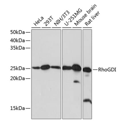 Western Blot - Anti-RhoGDI Antibody [ARC0629] (A309147) - Antibodies.com