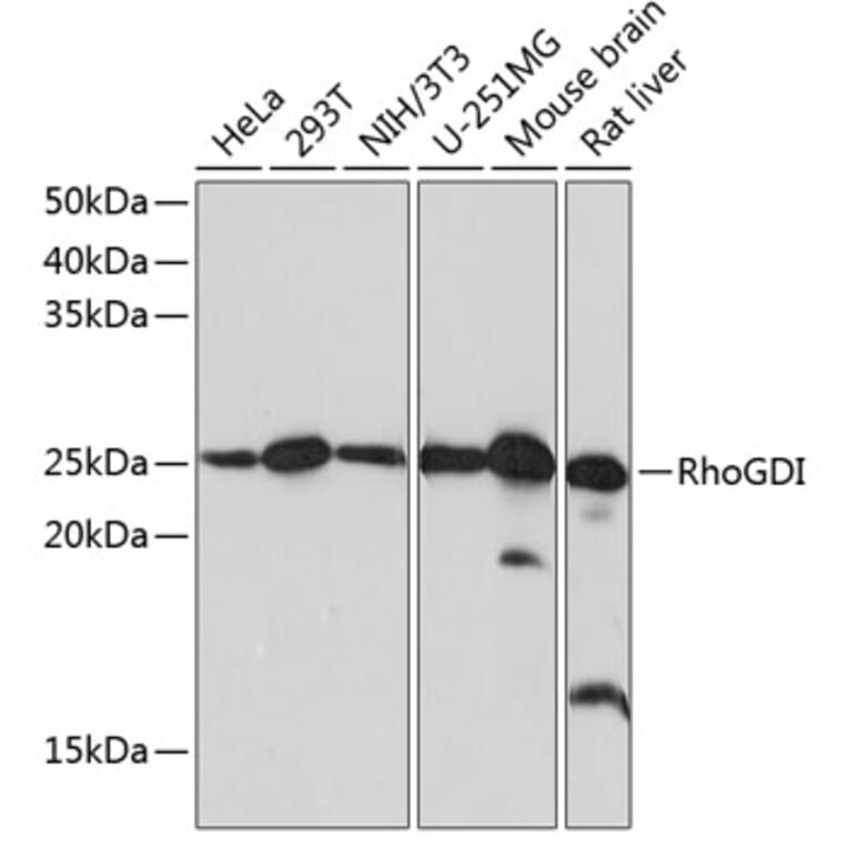 Western Blot - Anti-RhoGDI Antibody [ARC0629] (A309147) - Antibodies.com