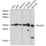 Western Blot - Anti-RhoGDI Antibody [ARC0629] (A309147) - Antibodies.com