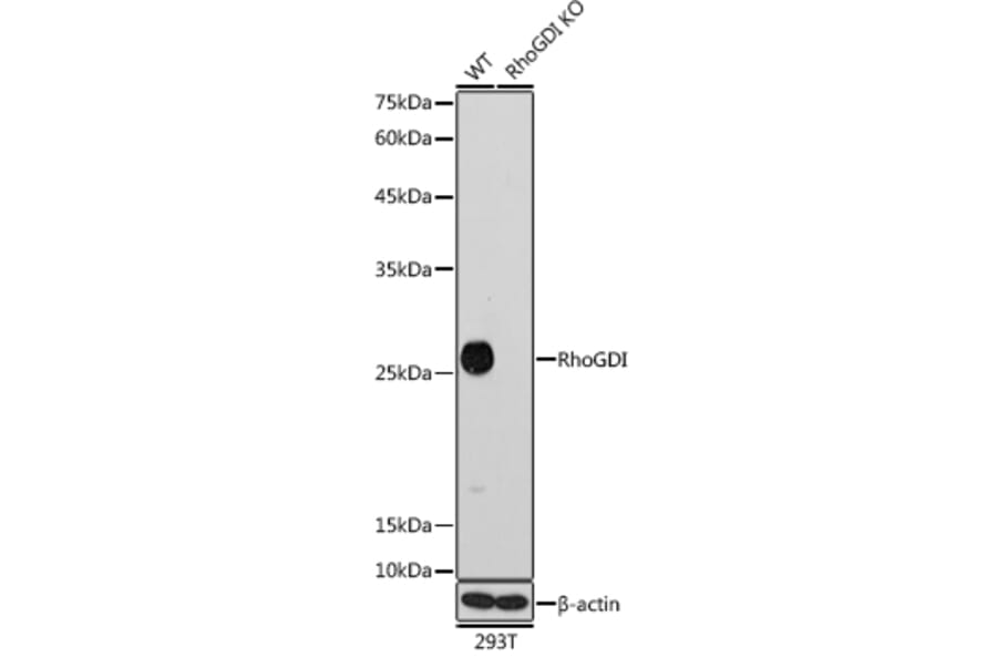 Western Blot - Anti-RhoGDI Antibody [ARC0629] (A309147) - Antibodies.com