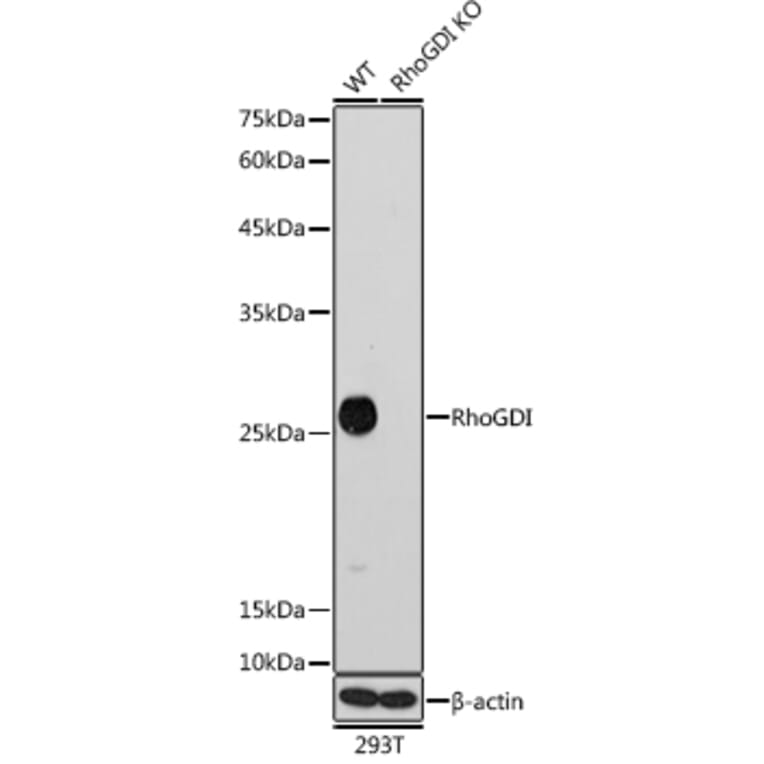 Western Blot - Anti-RhoGDI Antibody [ARC0629] (A309147) - Antibodies.com