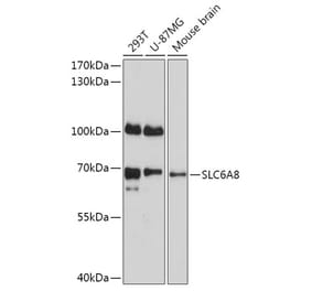 Western Blot - Anti-SLC6A8 Antibody (A309148) - Antibodies.com