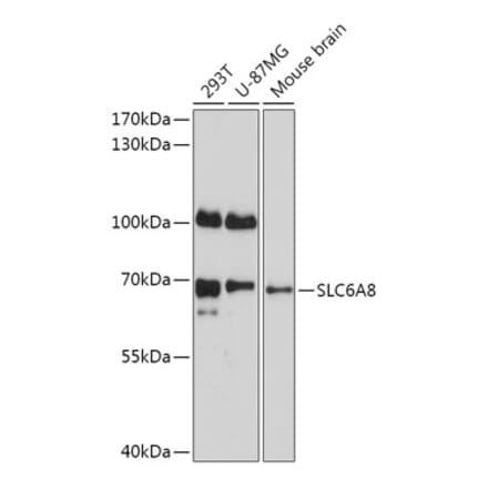 Western Blot - Anti-SLC6A8 Antibody (A309148) - Antibodies.com