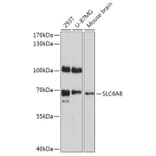 Western Blot - Anti-SLC6A8 Antibody (A309148) - Antibodies.com