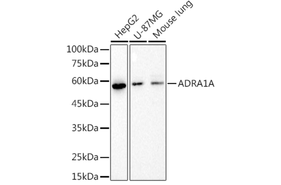 Western Blot - Anti-alpha 1a Adrenergic Receptor/ADRA1A Antibody [ARC2740] (A309149) - Antibodies.com