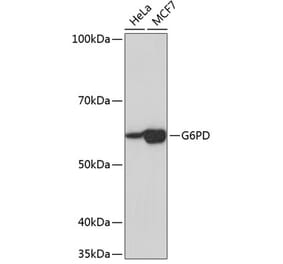 Western Blot - Anti-Glucose 6 Phosphate Dehydrogenase Antibody [ARC0553] (A309151) - Antibodies.com