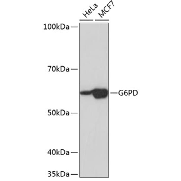 Western Blot - Anti-Glucose 6 Phosphate Dehydrogenase Antibody [ARC0553] (A309151) - Antibodies.com
