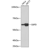 Western Blot - Anti-Glucose 6 Phosphate Dehydrogenase Antibody [ARC0553] (A309151) - Antibodies.com
