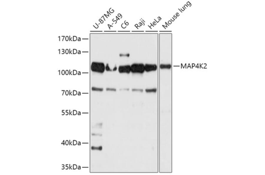 Western Blot - Anti-Germinal Center Kinase/GCK Antibody (A309153) - Antibodies.com