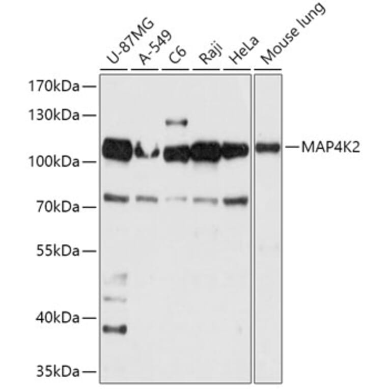 Western Blot - Anti-Germinal Center Kinase/GCK Antibody (A309153) - Antibodies.com