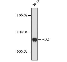 Western Blot - Anti-MUC4 Antibody [ARC1999] (A309154) - Antibodies.com