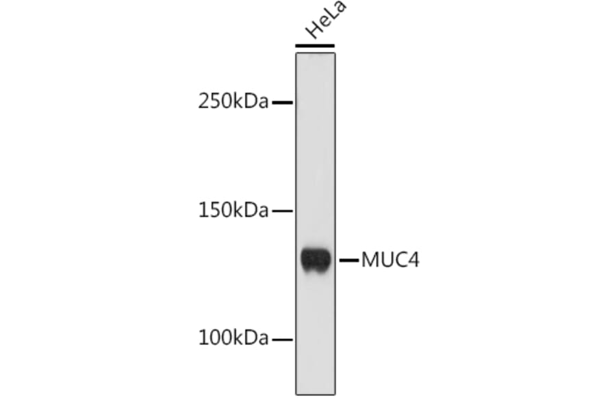Western Blot - Anti-MUC4 Antibody [ARC1999] (A309154) - Antibodies.com