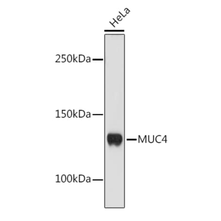 Western Blot - Anti-MUC4 Antibody [ARC1999] (A309154) - Antibodies.com