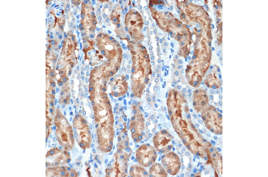 Immunohistochemistry - Anti-MUC4 Antibody [ARC1999] (A309154) - Antibodies.com