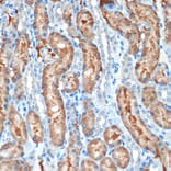 Immunohistochemistry - Anti-MUC4 Antibody [ARC1999] (A309154) - Antibodies.com