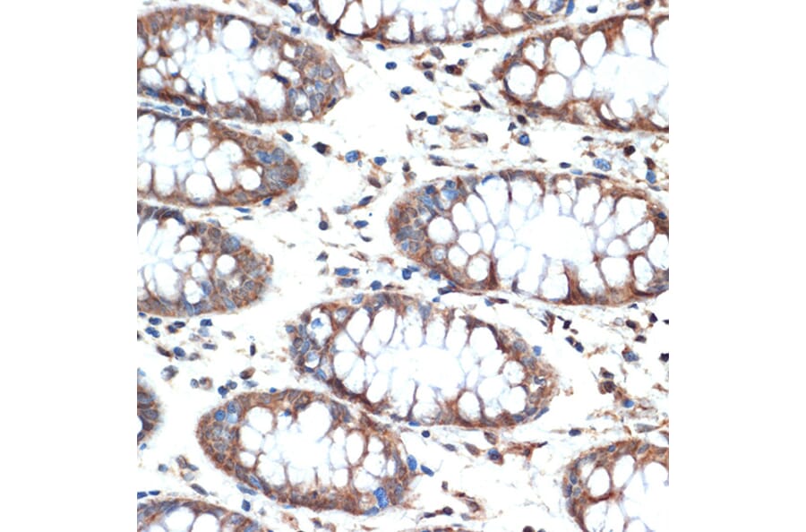 Immunohistochemistry - Anti-MUC4 Antibody [ARC1999] (A309154) - Antibodies.com