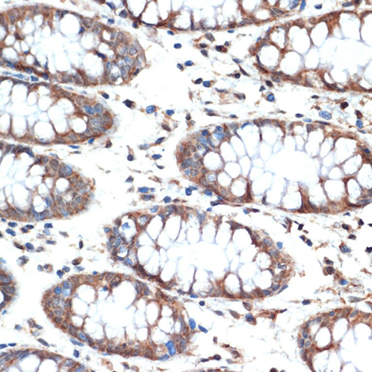 Immunohistochemistry - Anti-MUC4 Antibody [ARC1999] (A309154) - Antibodies.com